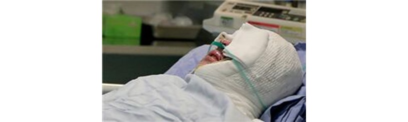 آخرین جزئیات از سوختگی شدید ۲ زن بر اثر اسیدپاشی در تهران  
