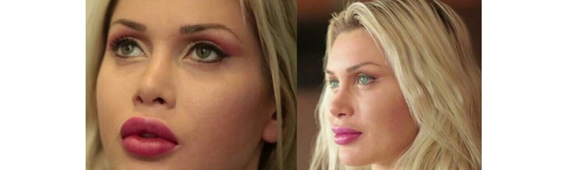 فردی که مدل خارجی را برای جراحی زیبایی به ایران آورده بود دستگیر شد
