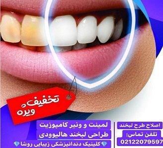 دندانپزشکی زیبایی ارزان تهران