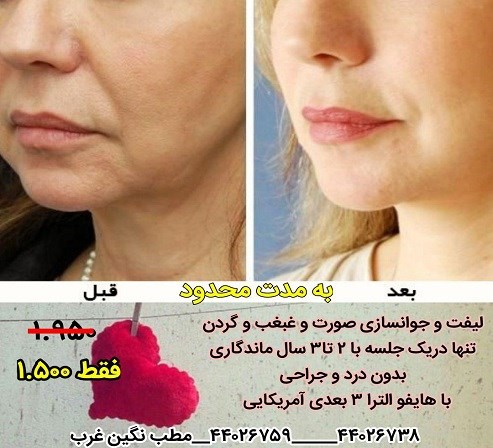 کلینیک زیبایی غرب تهران