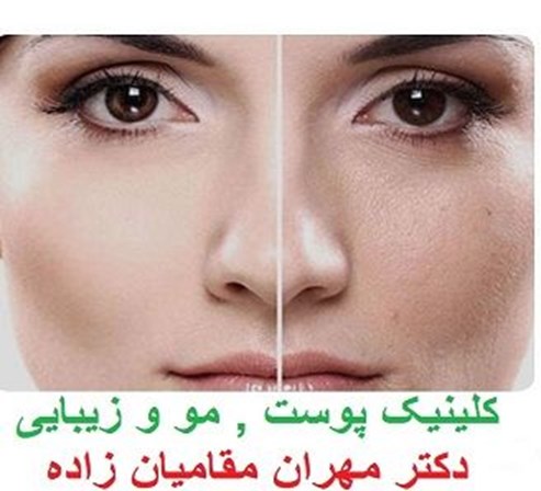 کلینیک پوست مو و زیبایی کرج